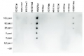 H3K27ac | Histone H3 acetylated lysine 27 (ChIP grade)
